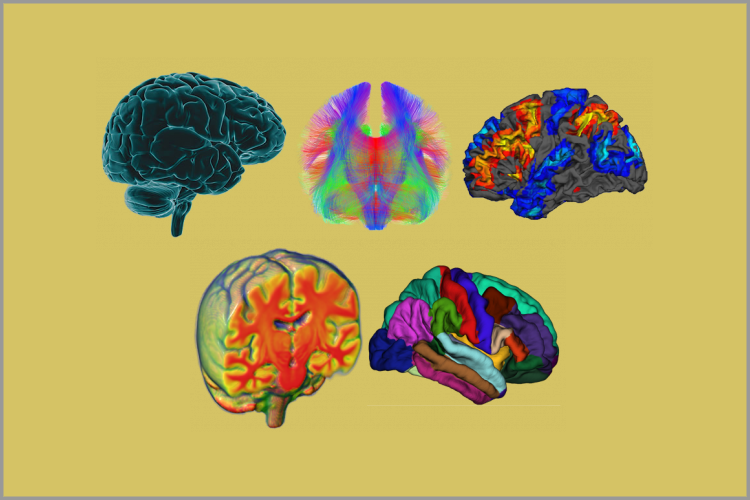 Kennedy Neuroimaging of Aging and Cognition (KNAC) Lab